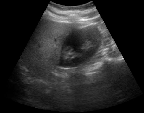Original abdominal ultrasound image